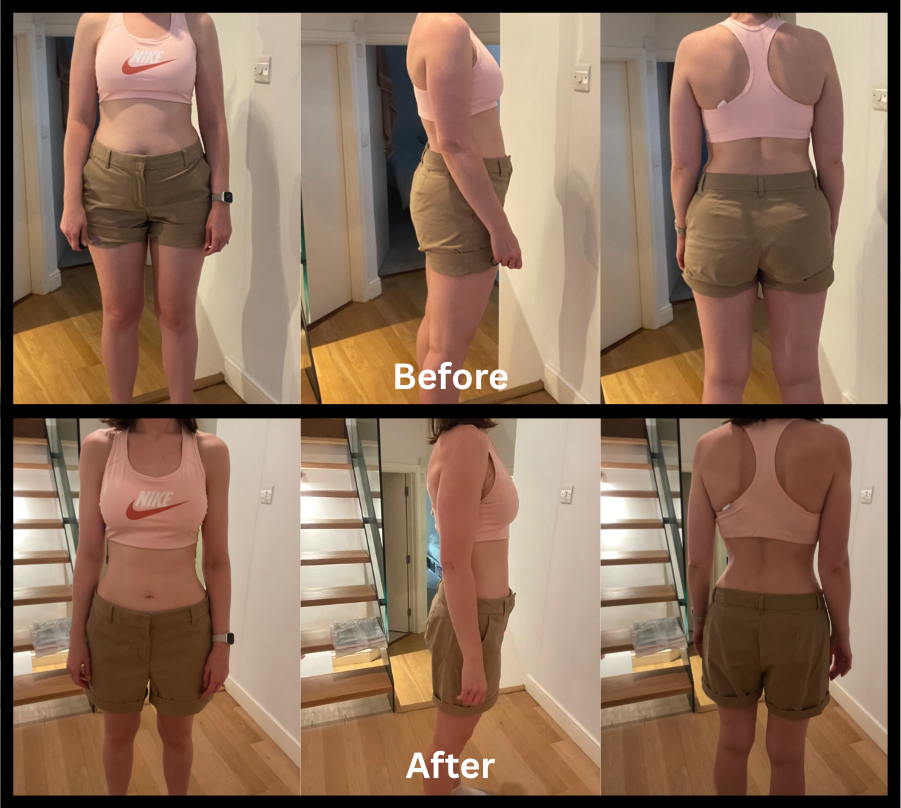 Anna's transformation journey - Before and After progress photos showing front, side, and back views